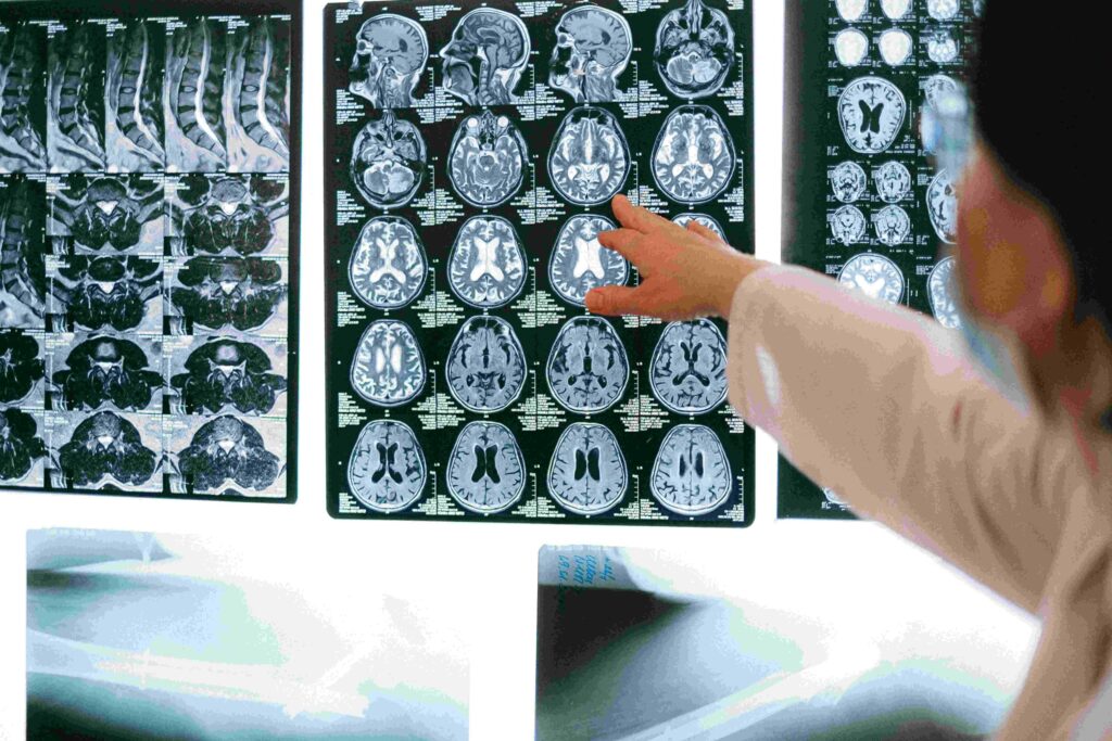 Ολόσωμη Μαγνητική Τομογραφία (WB MRI)_ΒΙΟΙΑΤΡΙΚΙ_BIOIATRIKH_