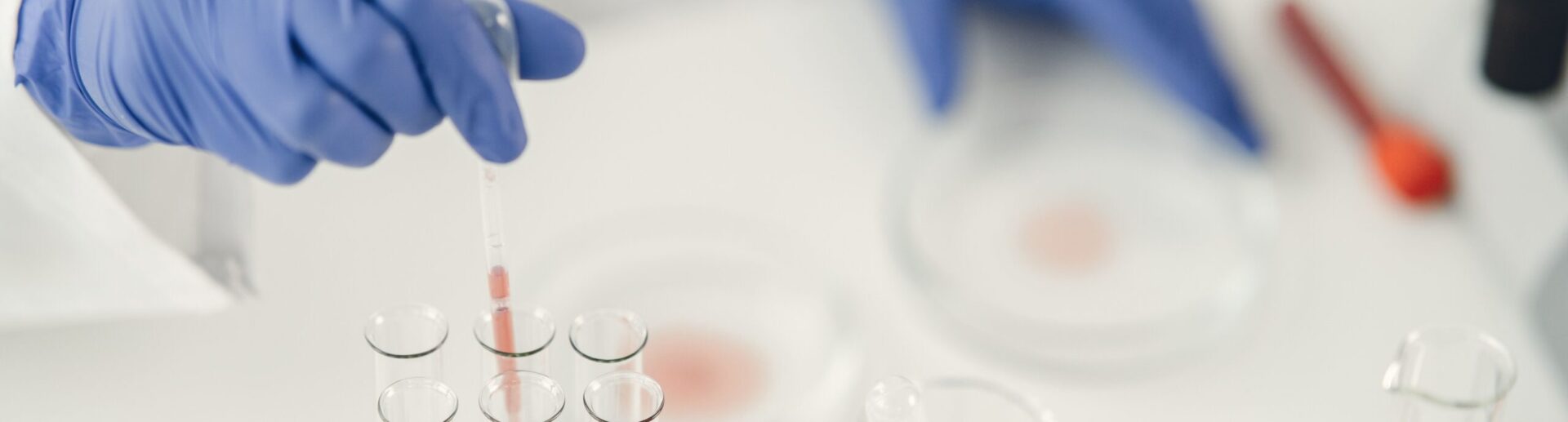 Ανοσολογίας & Ιστοσυμβατότητας_bioiatriki_βιοιατρική_